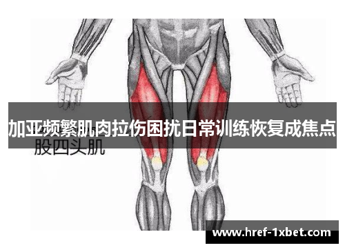 加亚频繁肌肉拉伤困扰日常训练恢复成焦点 加亚频繁肌肉拉伤困扰日常训练恢复成焦点